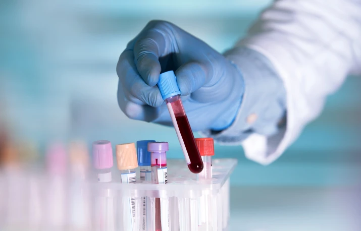 Un nou test de sânge poate detecta cu exactitate boala Alzheimer
