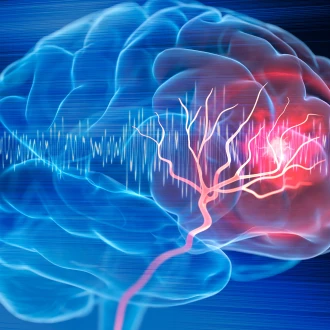 Cum poți să previi accidentul vascular cerebral