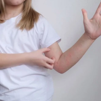 Dermatita atopică și intestinul – există o legătură?