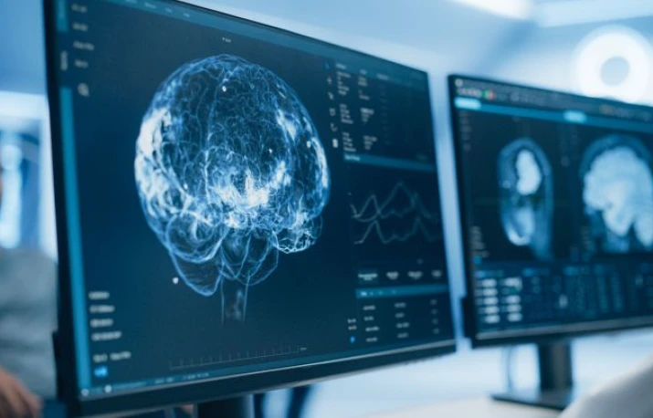 COGNOSCOPIA – analiza care îți arată riscul de Alzheimer cu 15 ani mai devreme