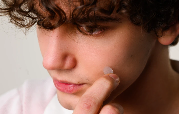 Cum alegi cei mai buni plasturi pentru coșuri? 5 criterii importante