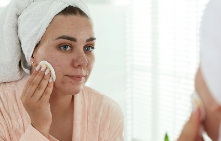 Prevenția și tratamentul acneei iarna