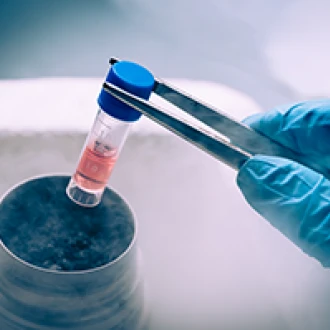 Studiu: celulele stem sunt benefice in tratarea disfunctiilor erectile ulterioare tratamentului de cancer 