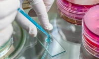 Homocisteina: toxina periculoasă organismului