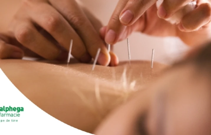 Acupunctura – pregatire pentru nastere 