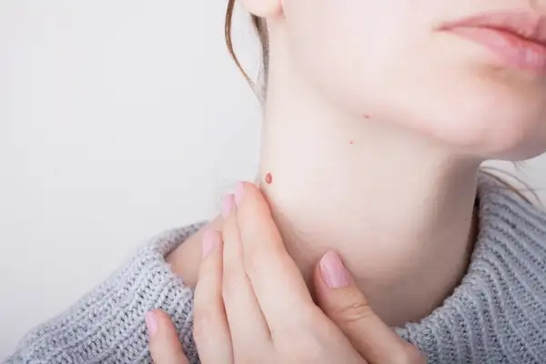 ou de vierme mărimea unui om human papilloma virus literature